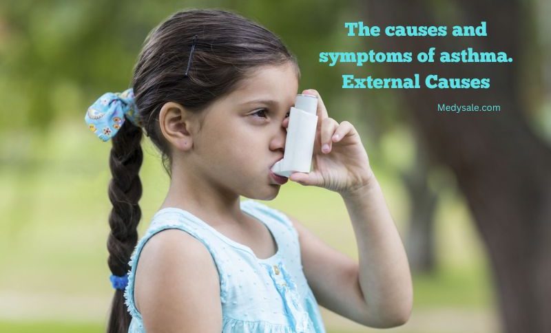 The causes and symptoms of asthma. External Causes